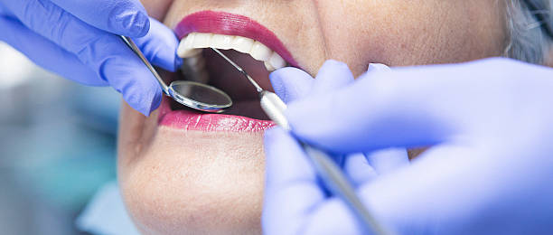 Best Emergency Root Canal Therapy in Clayco, MO